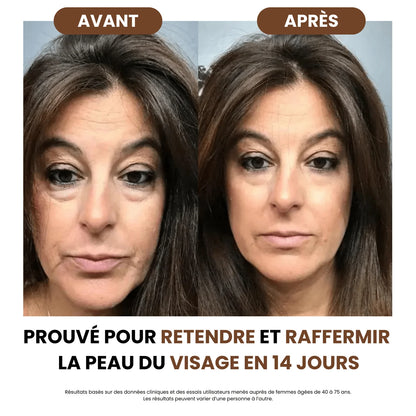 Brosse Sculptante & Drainage Lymphatique