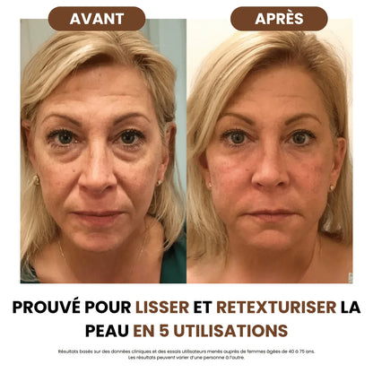 Brosse Sculptante & Drainage Lymphatique